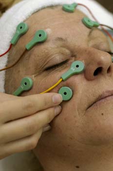 Electrolifing: colocación de los electrodos