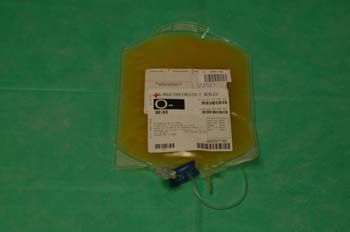 Bolsa de plasma sanguíneo