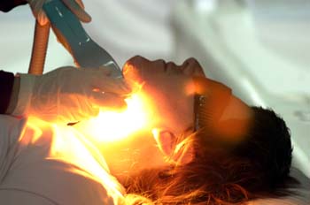 Fotodepilación: disparo luminoso