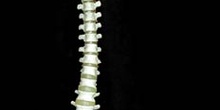 Columna Vertebral y Cadera