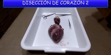 DISECCIÓN DE CORAZÓN - ANATOMÍA INTERNA
