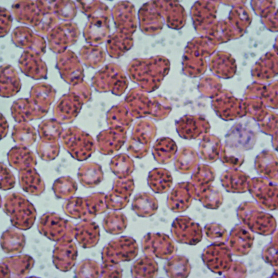 Células sanguíneas 2