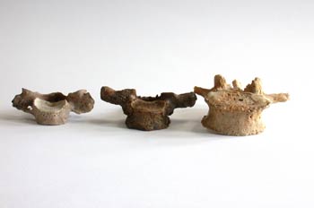 Vista frontal de la vértebra cervical, torácica y lumbar