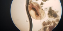 Imágenes de pulga de agua (Daphnia pulex)