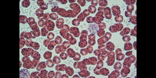 Células sanguíneas 1