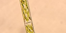 Alga Spyrogira