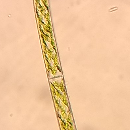 Alga Spyrogira