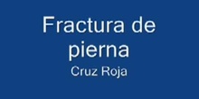 Fractura de pierna