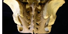 Vista posterior de una cadera con ligamentos