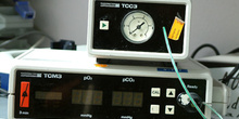 Aparato transcutáneo de CO2
