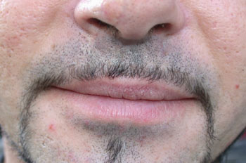 Bigote