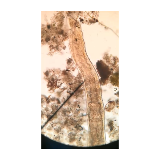 Oligoqueto Chaetogaster