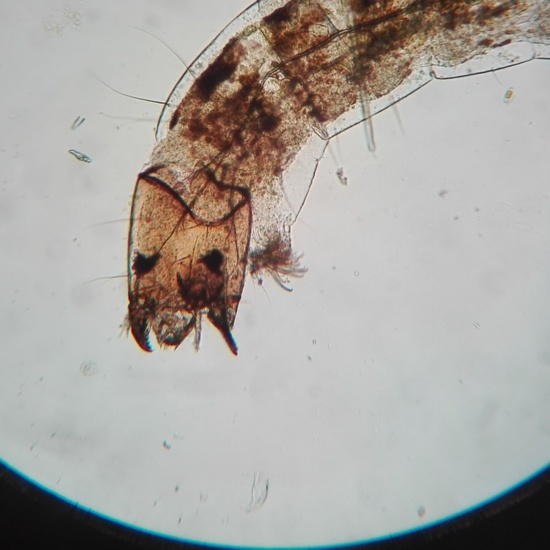 LARVA DE QUIRONÓMIDO. CABEZA