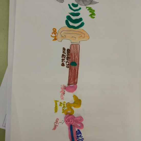 Día Internacional del Implante Coclear - ¿Cómo funciona un implante? 10